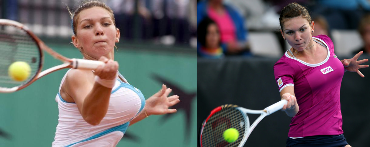 Simona Halep breasts - before and after